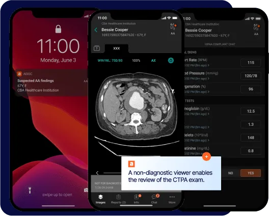 Aidoc, uno strumento di IA nel settore sanitario (Ideale per fornire supporto basato sull'IA ai radiologi)