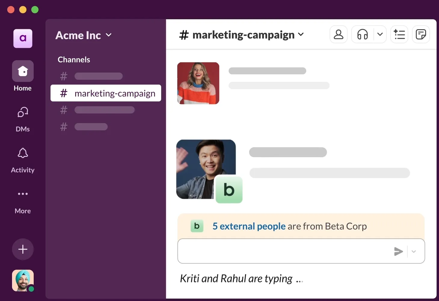 Slack